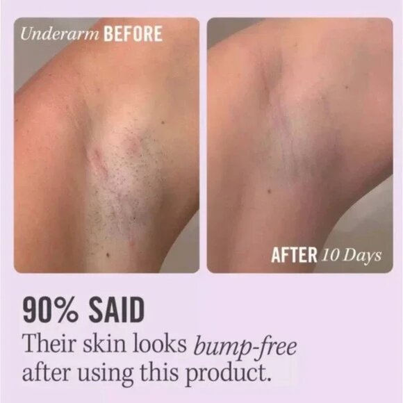 NWT First Aid Beauty Ingrown Hair Pads with BHA & AHA 28ct - Picture 3 of 7